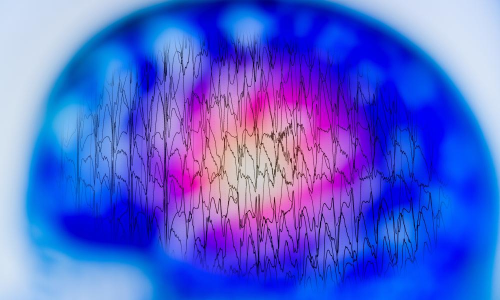 EEG of brain 